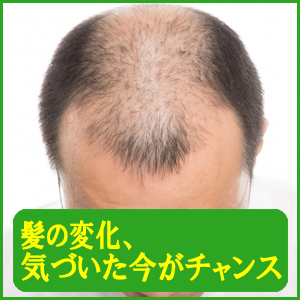その薄毛、まだ諦めないで！！